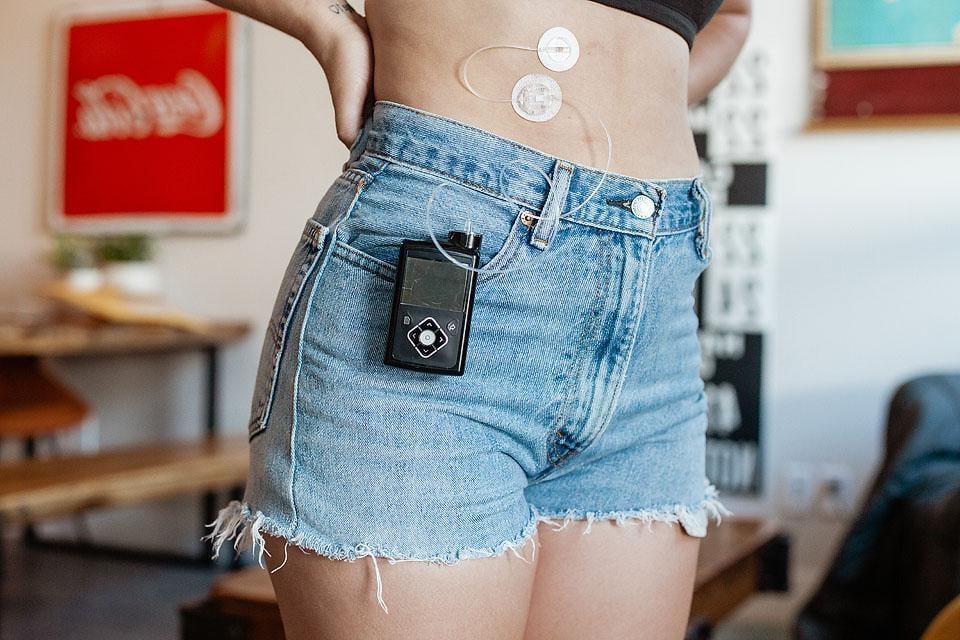 Η Bella Bucchiotti της xoxoBella είναι lifestyle blogger με Διαβήτη Τύπου 1. Αυτή η ανάρτηση μοιράζεται μερικούς μύθους για τον Διαβήτη Τύπου 1 για να αυξήσει την ευαισθητοποίηση για τον διαβήτη.
